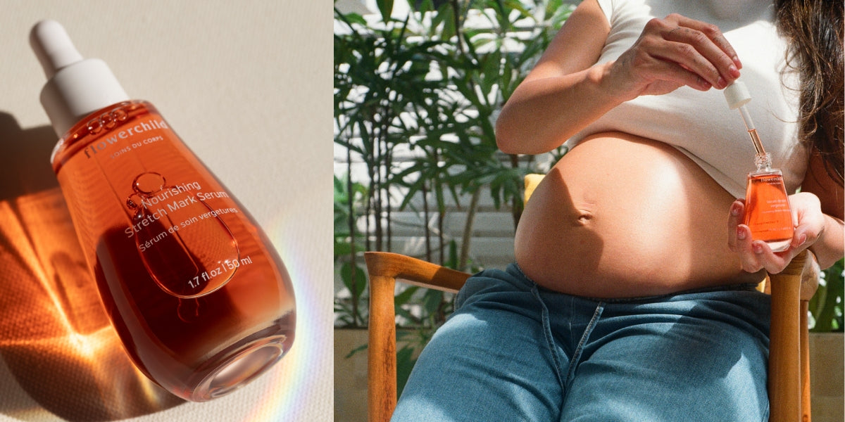 Flowerchild stretch mark serum featured in Flowerchild vs Hatch vs Bio-Oil comparison for the best stretch mark prevention in 2026