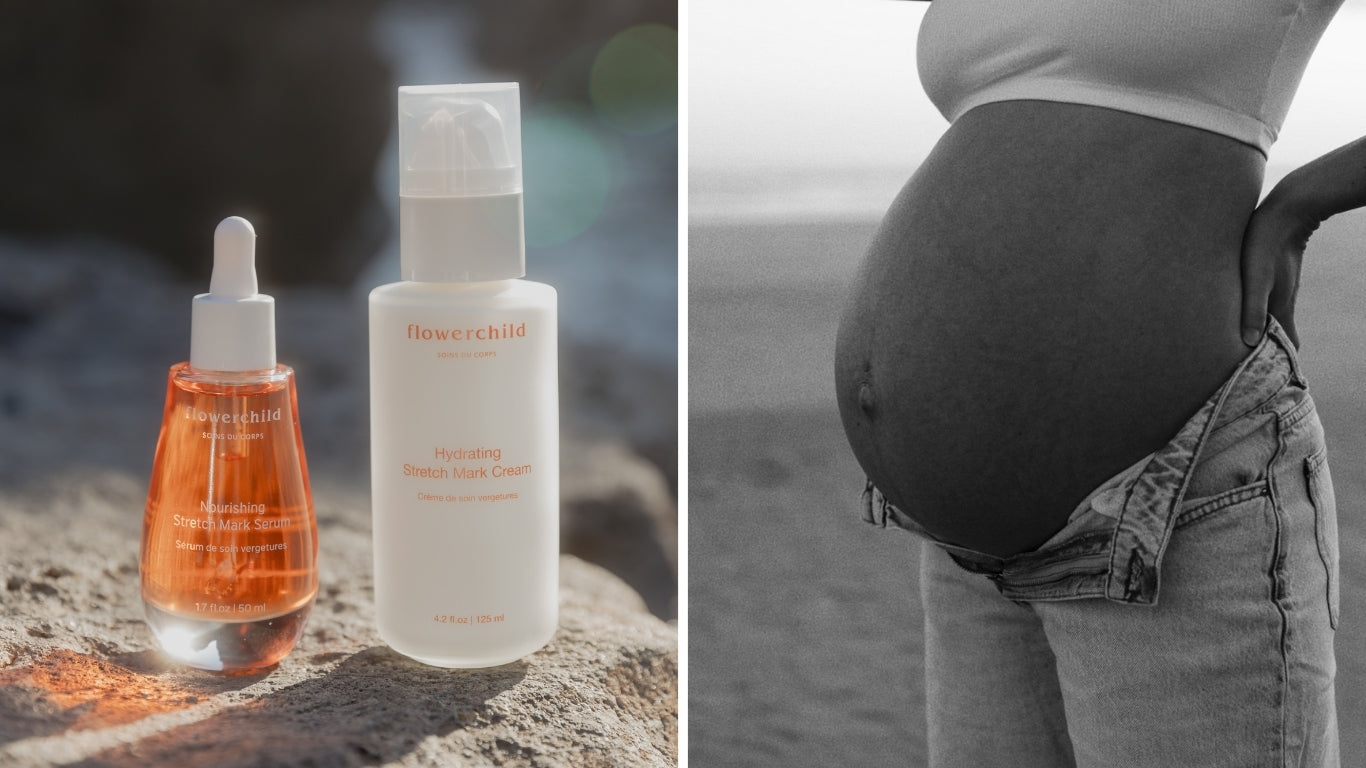 Duo de soins vergetures Flowerchild, sérum nourrissant et crème hydratante, aux côtés d’un ventre de femme enceinte, soins naturels pour la maternité.